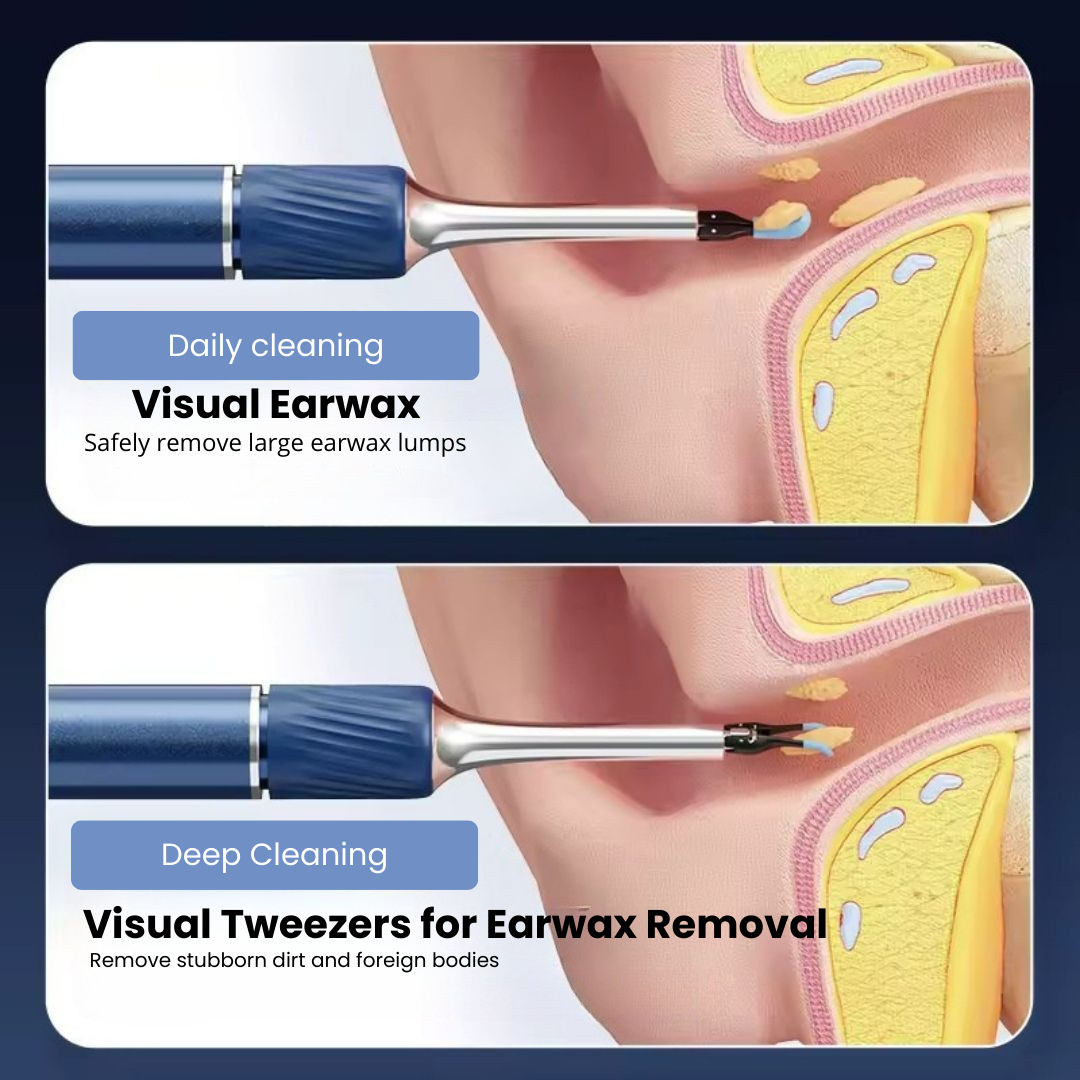 Smart Ear Cleaner – Wireless with Camera (Android/iOS)